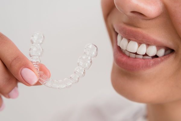 Schöne Zähne und ein schönes Lächeln erreichen wir in der ästhetischen Zahnmedizin mit Bleaching oder Veneers.